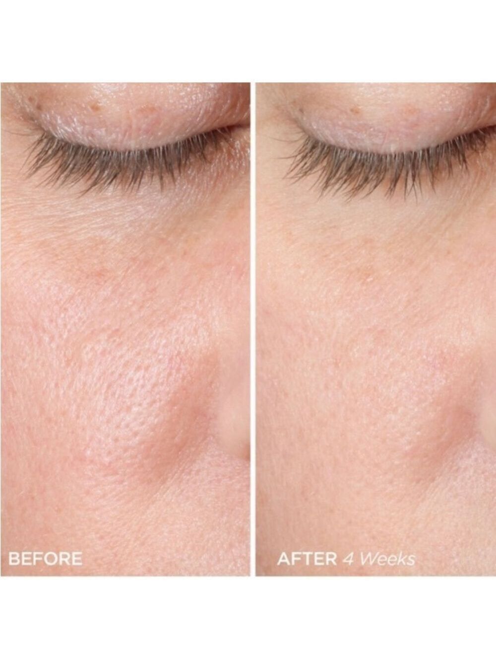 BeautyBio ZenBubble Gel Facial Cream Moisturizer - Picture 4 of 13